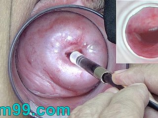 La cámara endoscopio japonés dentro del cuello uterino en polar vagina Cam